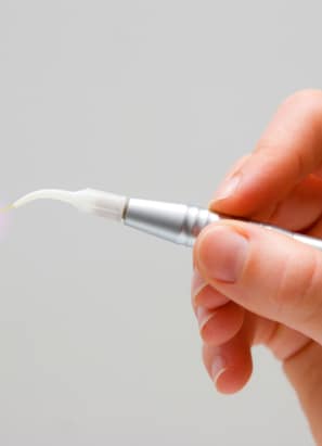 Hand holding a tool for laser dentistry.